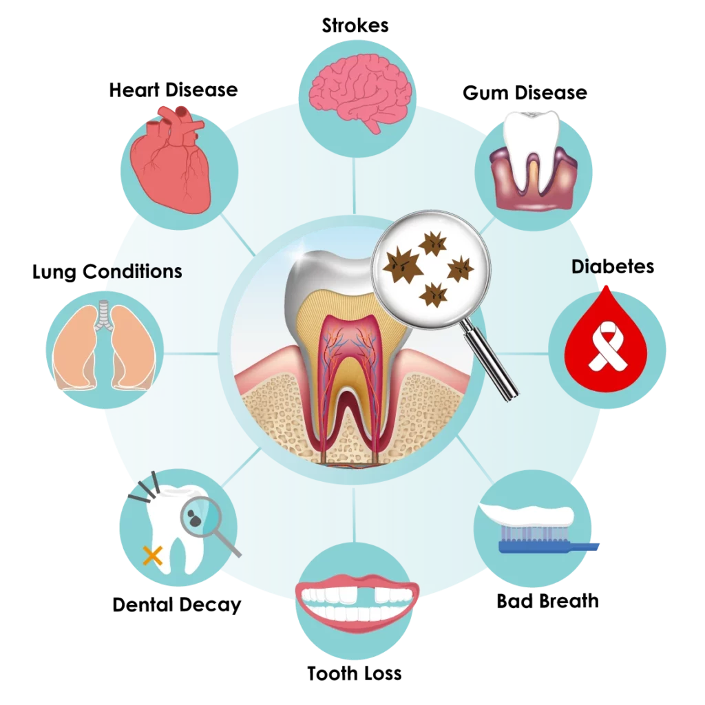 Graphic showing what periodontitis can lead to without regular periodontal therapy.