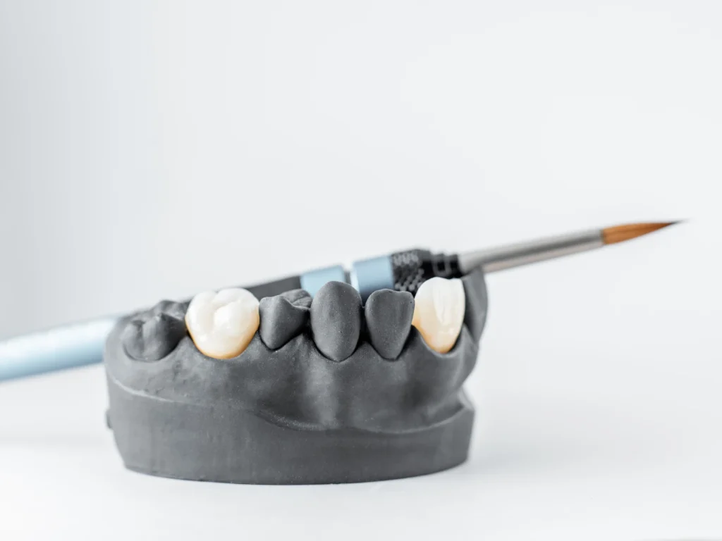 lower jaw model with porcelain dental crowns