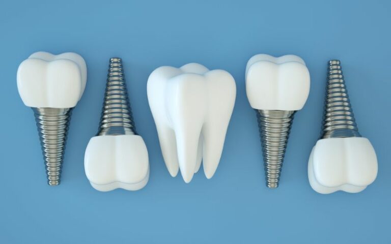 Photo of dental implants lined up next to eachother.